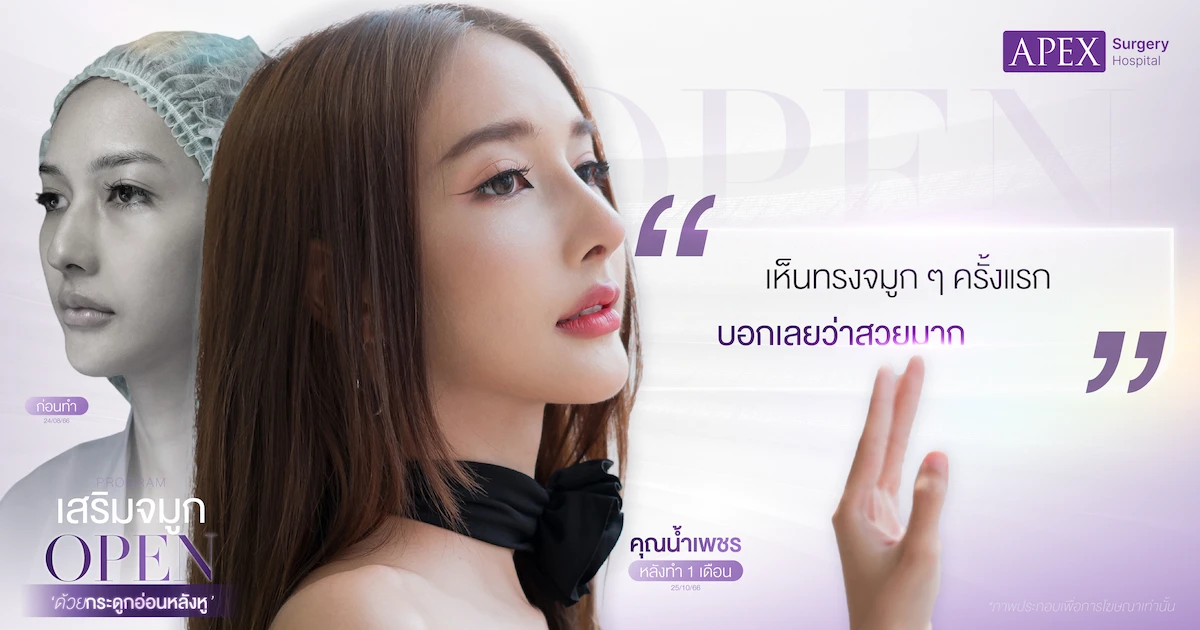 รีวิวเสริมจมูกที่ไหนดี
