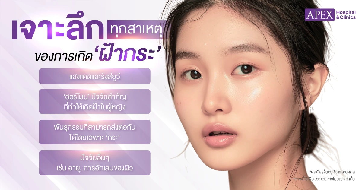ฝ้า กระ