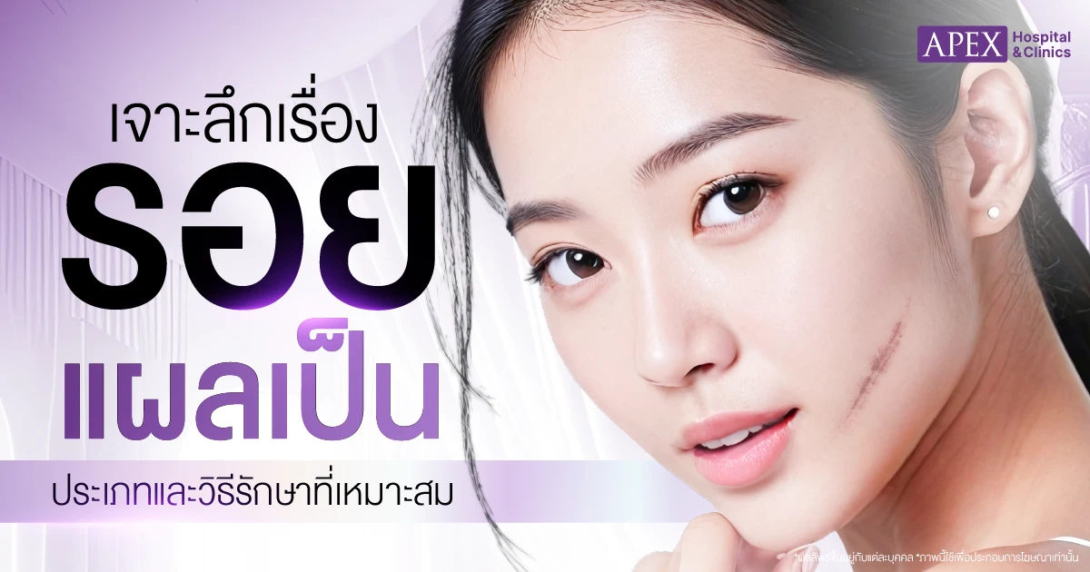 รอยแผลเป็น