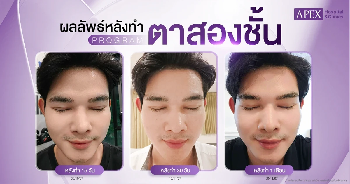 รีวิวตาสองชั้น