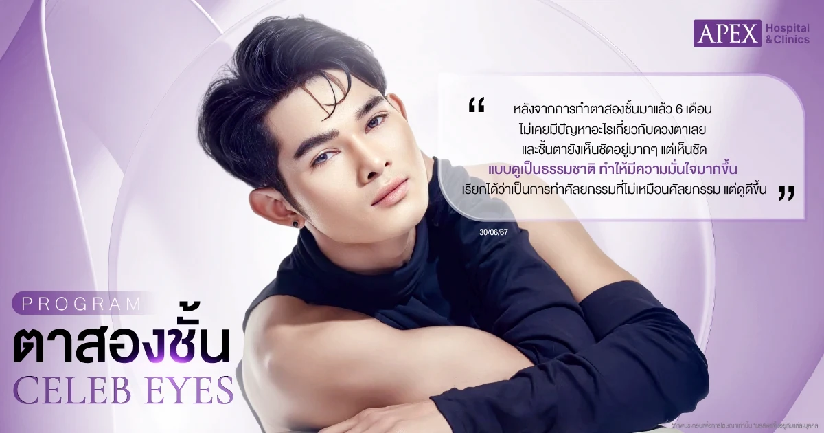 รีวิวหลังทำตาสองชั้น