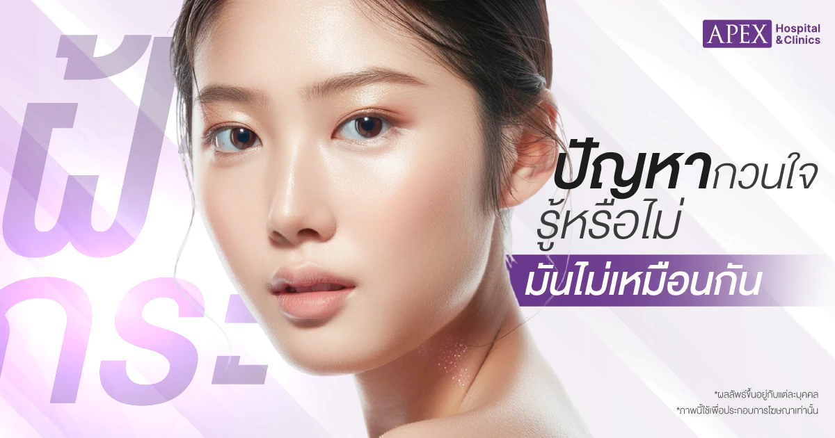 ฝ้า กระ