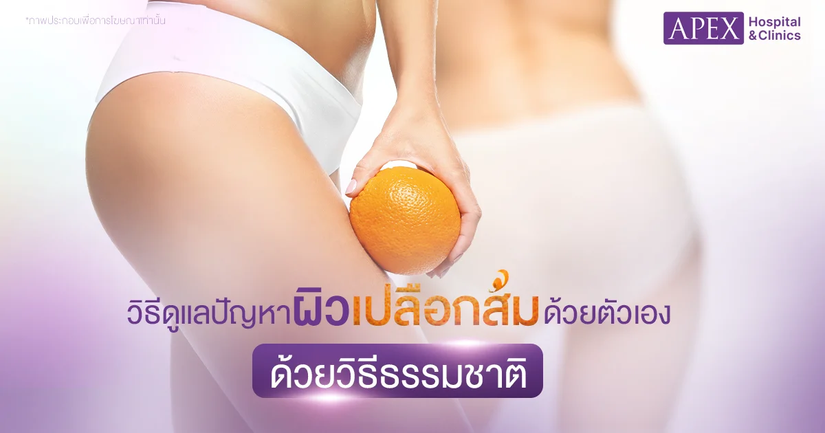 วิธีดูแลผิวเปลือกส้ม