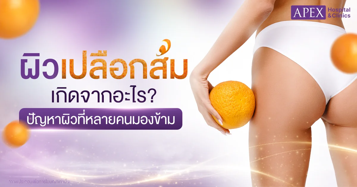 ผิวเปลือกส้ม