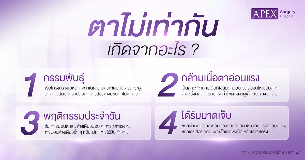 ตาไม่เท่ากัน เกิดจาก
