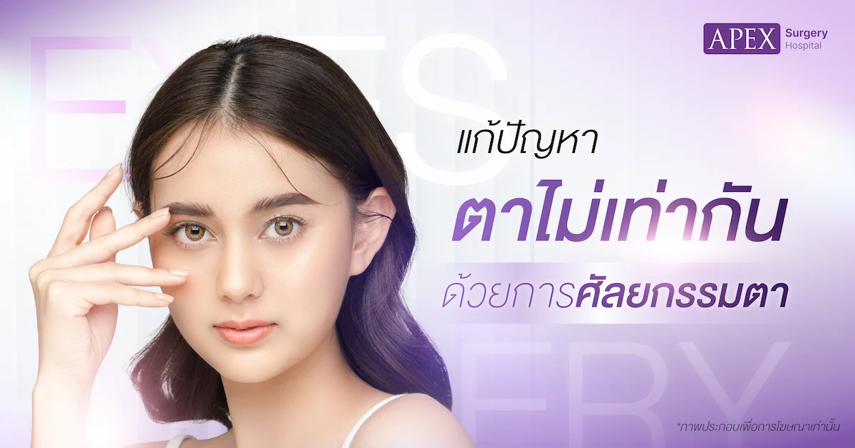 ตาไม่เท่ากัน