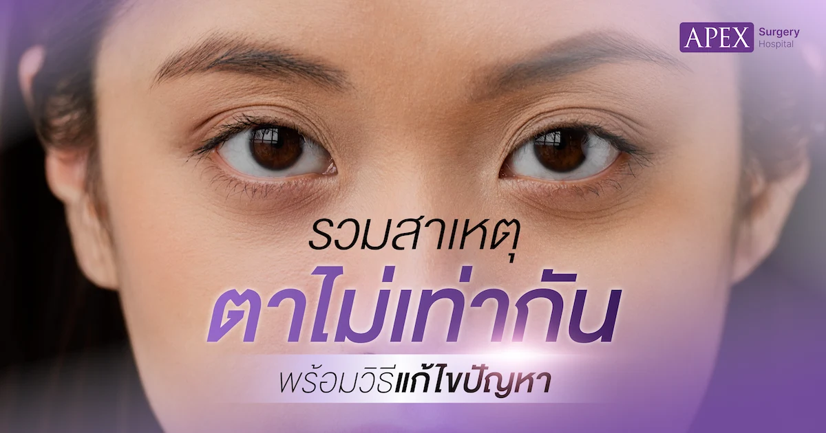 ตาไม่เท่ากัน