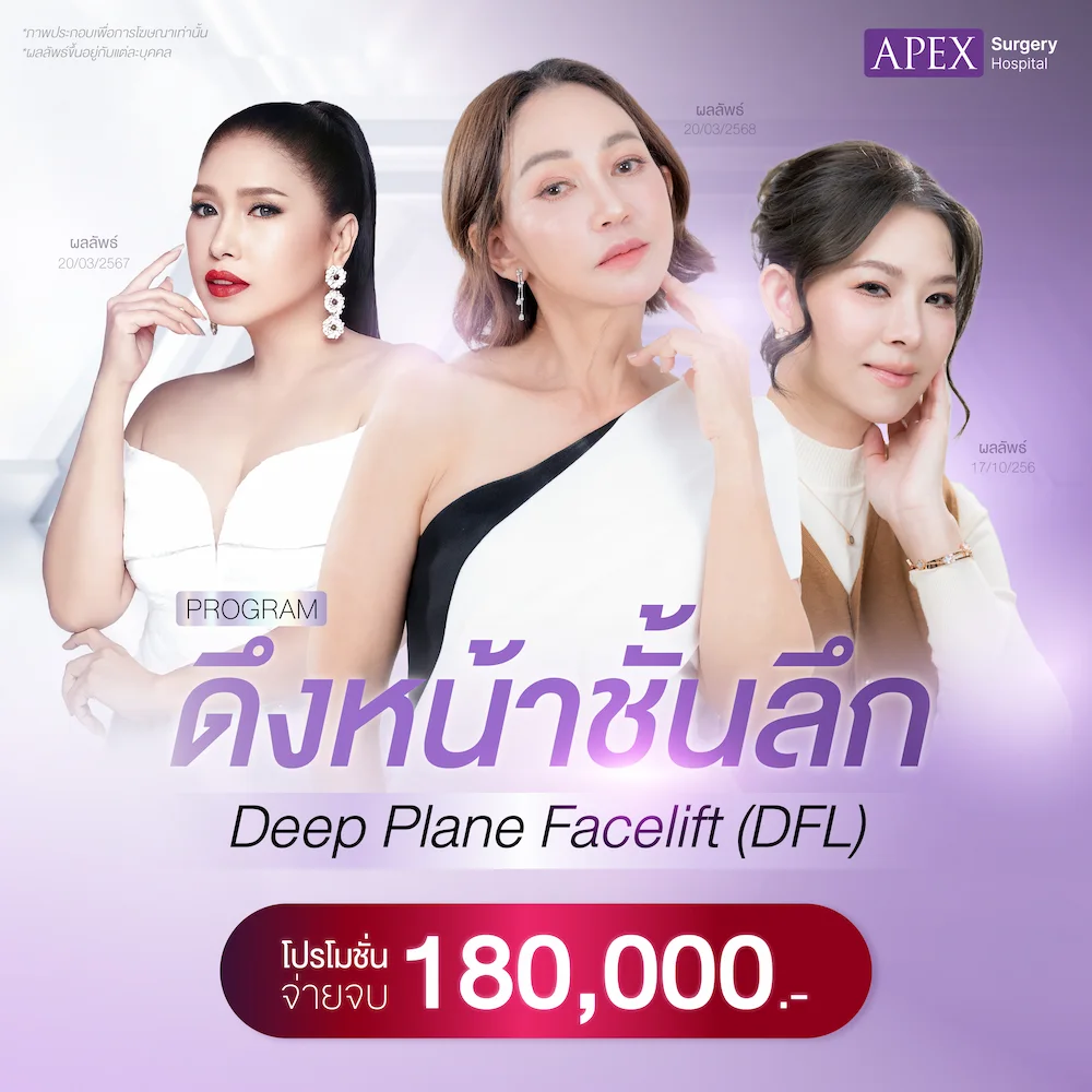 ดึงหน้า ราคา 180,000