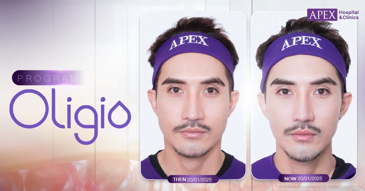 รีวิวยกกระชับหน้า Oligio