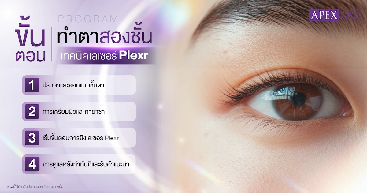 ขั้นตอนทำตาสองชั้นเทคนิคเลเซอร์ Plexr