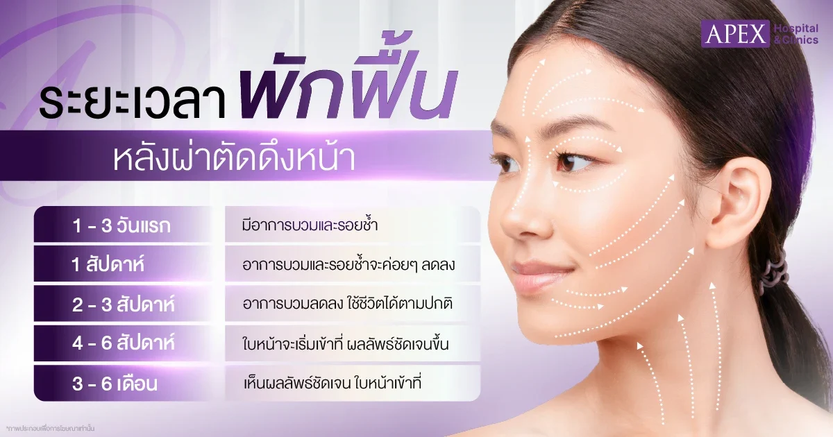 ระยะพักฟื้นแผลดึงหน้า