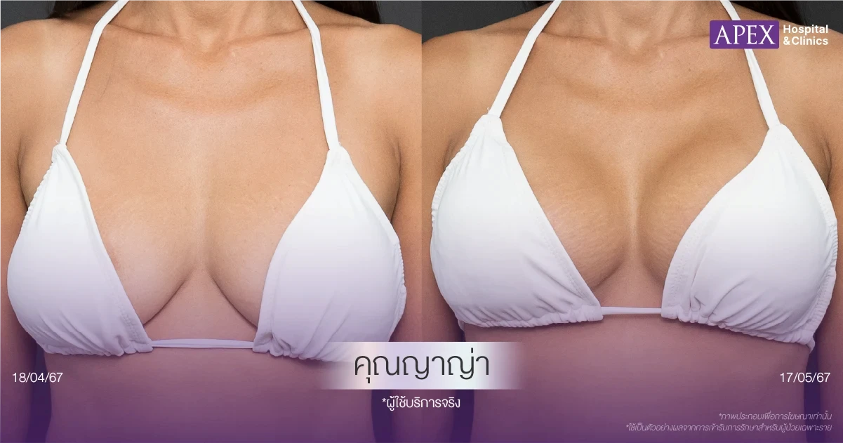 รีวิวแก้นมยาน