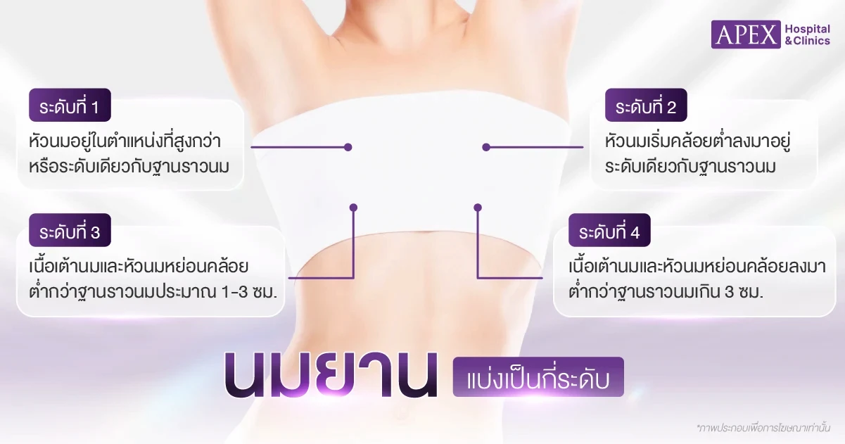 นมยาน มีกี่แบบ