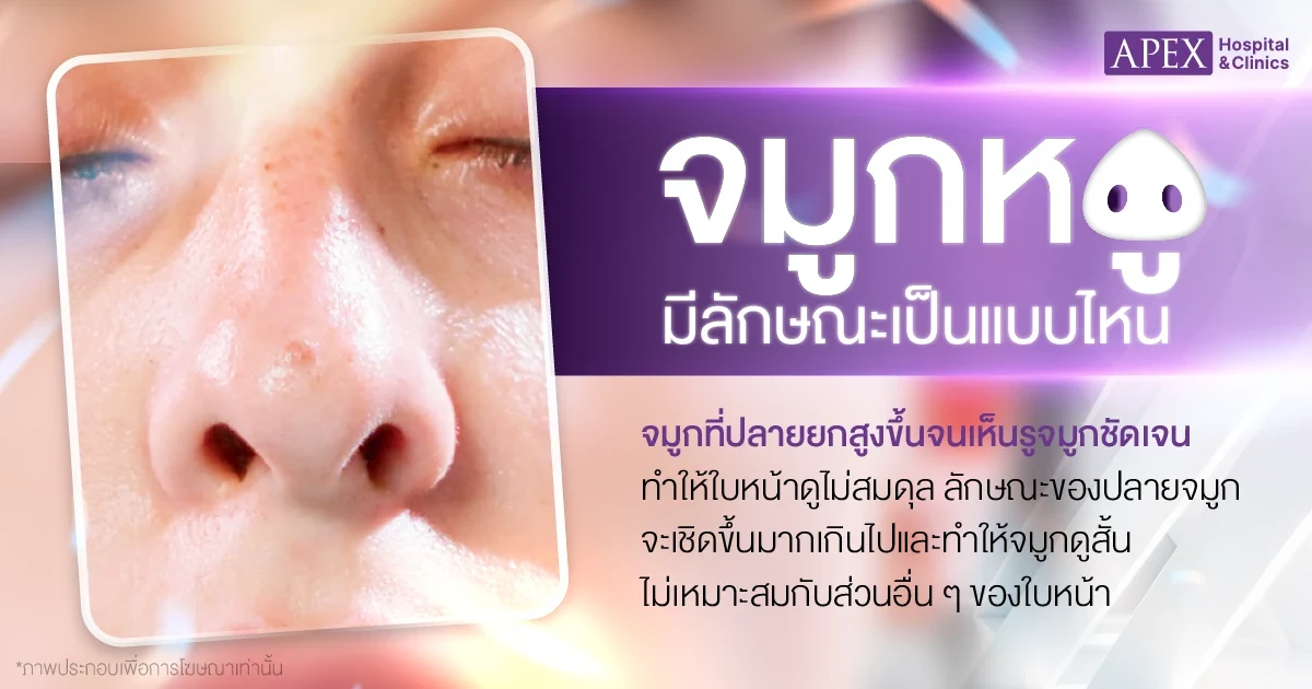 จมูกหมู ลักษณะเป็นอย่างไร