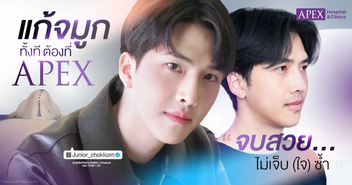 แก้จมูก ที่ไหนดี
