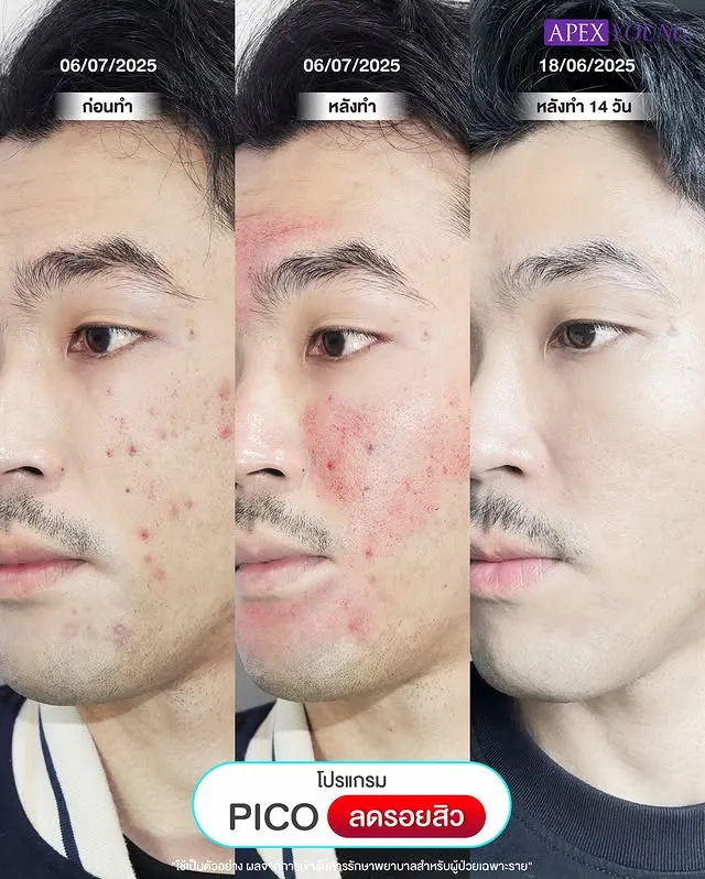 男生同样适用