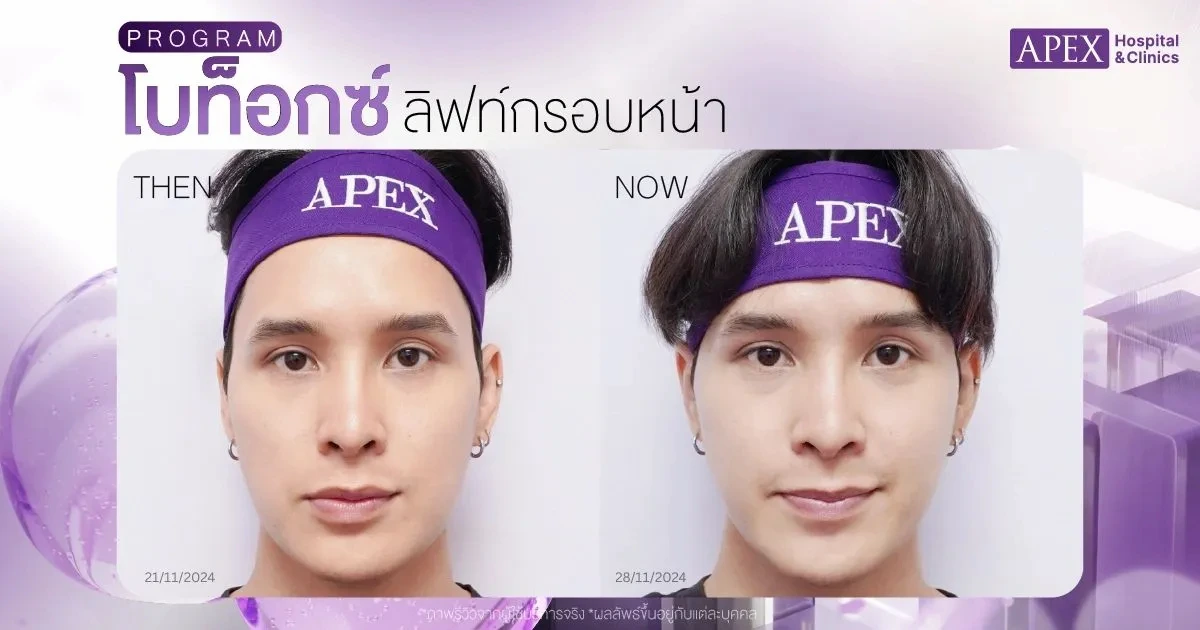 โบท็อกยกกระชับหน้า