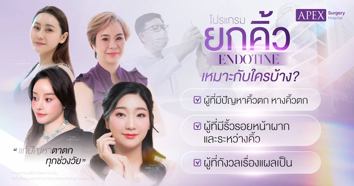 ยกคิ้ว Endotine เหมาะกับใคร