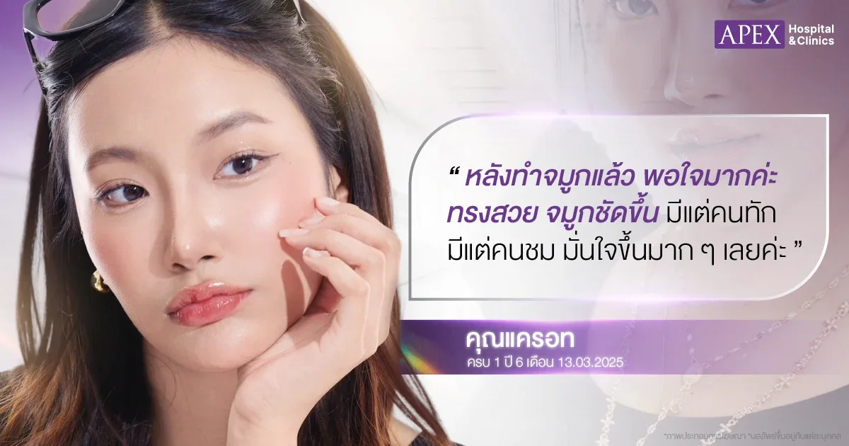 รีวิวเสริมจมูก apex