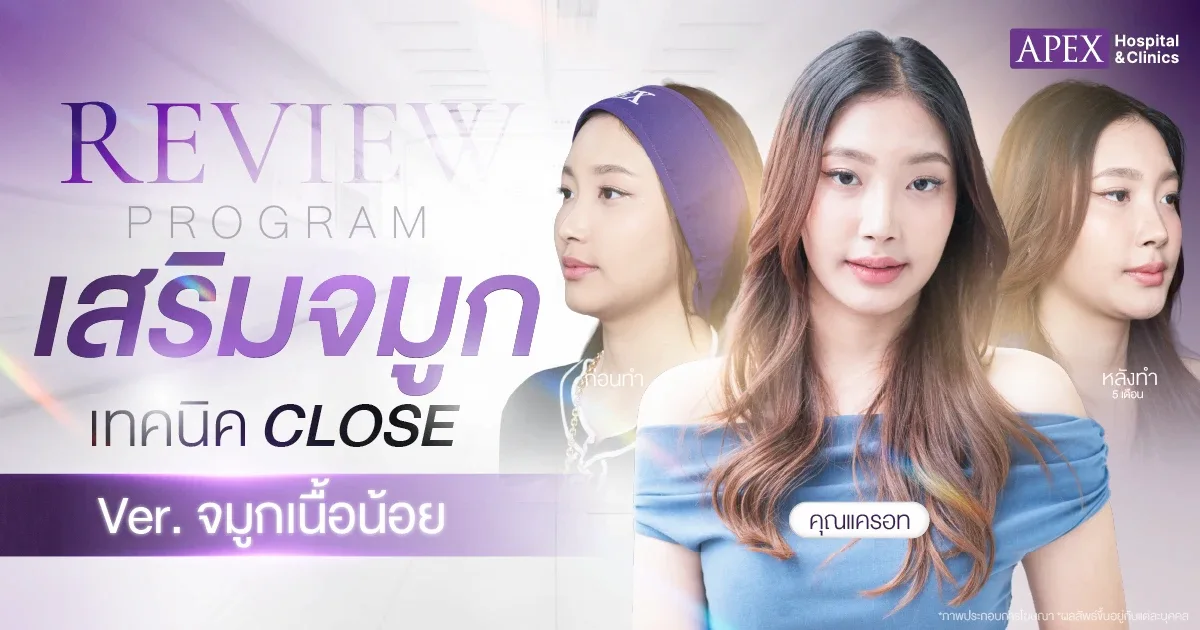 รีวิวเสริมจมูก