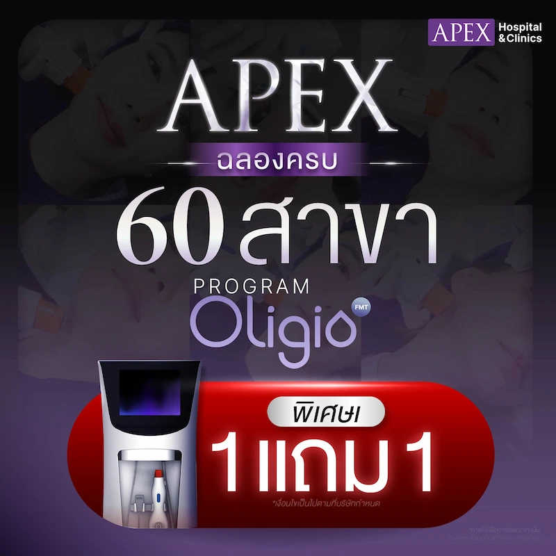 Oligio 1 แถม 1