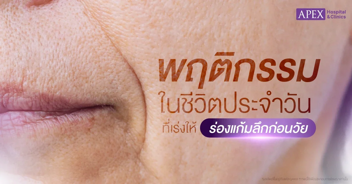 ร่องแก้มลึก