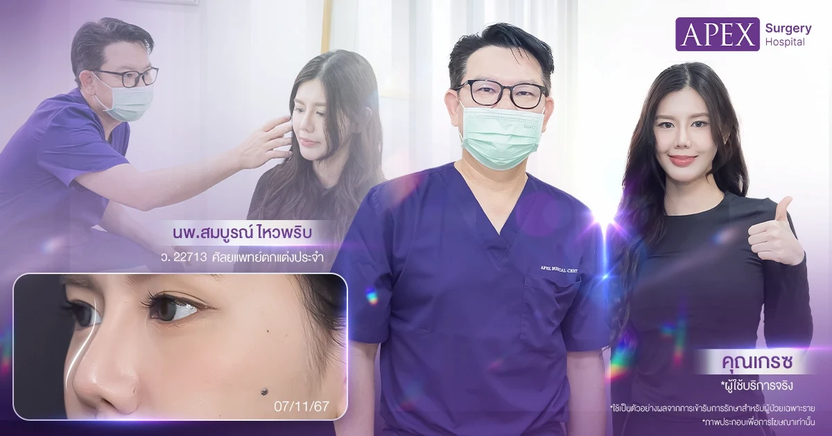 ปรึกษาก่อนเสริมจมูก