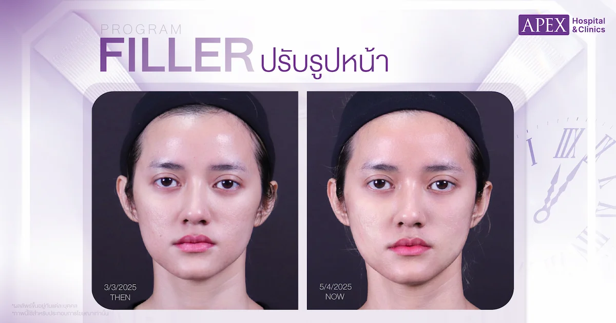 รีวิวผลลัพธ์แก้หน้ายุบ