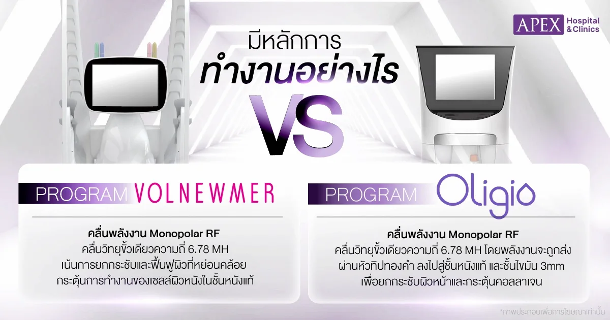 Volnewmer vs Oligio ทำงานอย่างไร