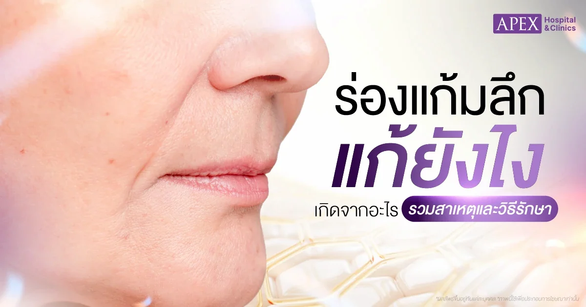 ร่องแก้มลึก เกิดจากอะไร