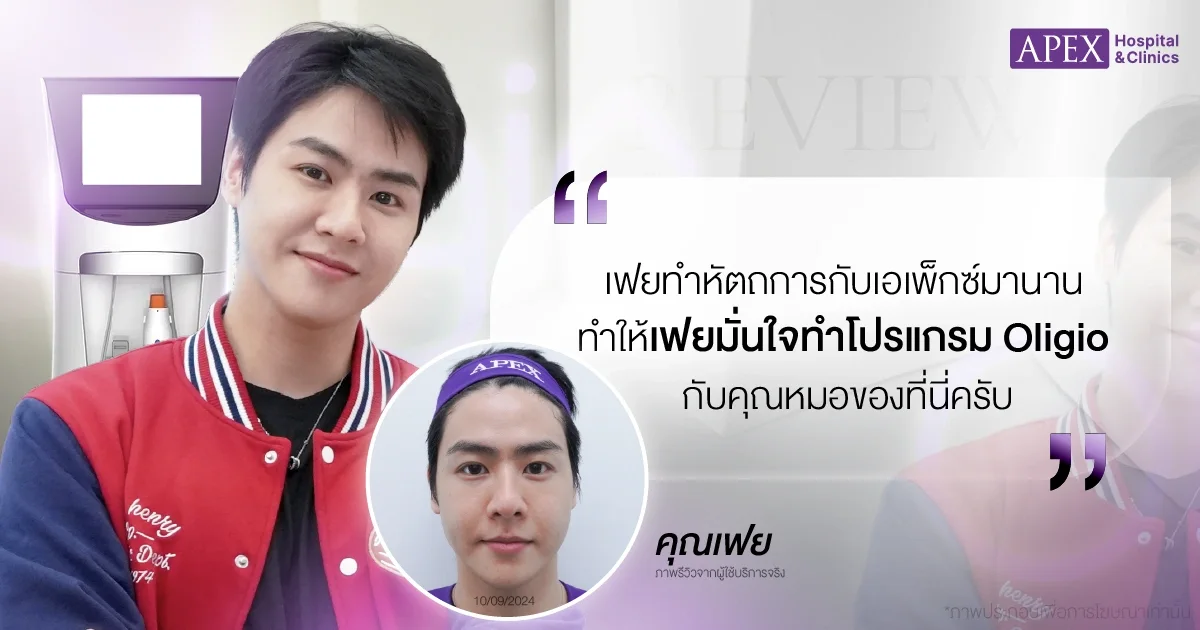 Oligio รีวิว โดยคุณเฟย