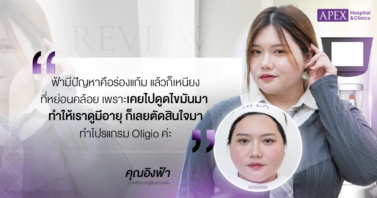 Oligio รีวิว โดยคุณอิงฟ้า