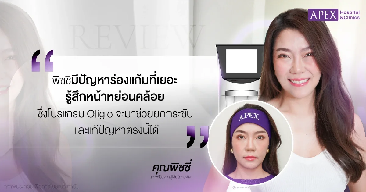 Oligio รีวิว โดยคุณพิชชี่