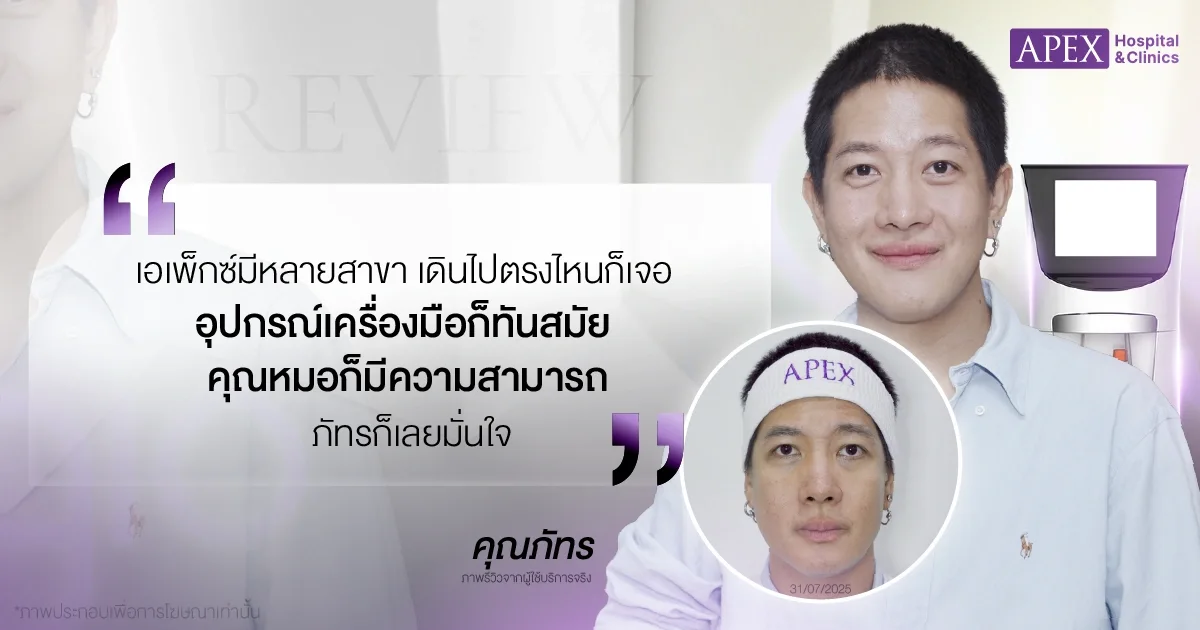 Oligio รีวิว โดยคุณภัทร