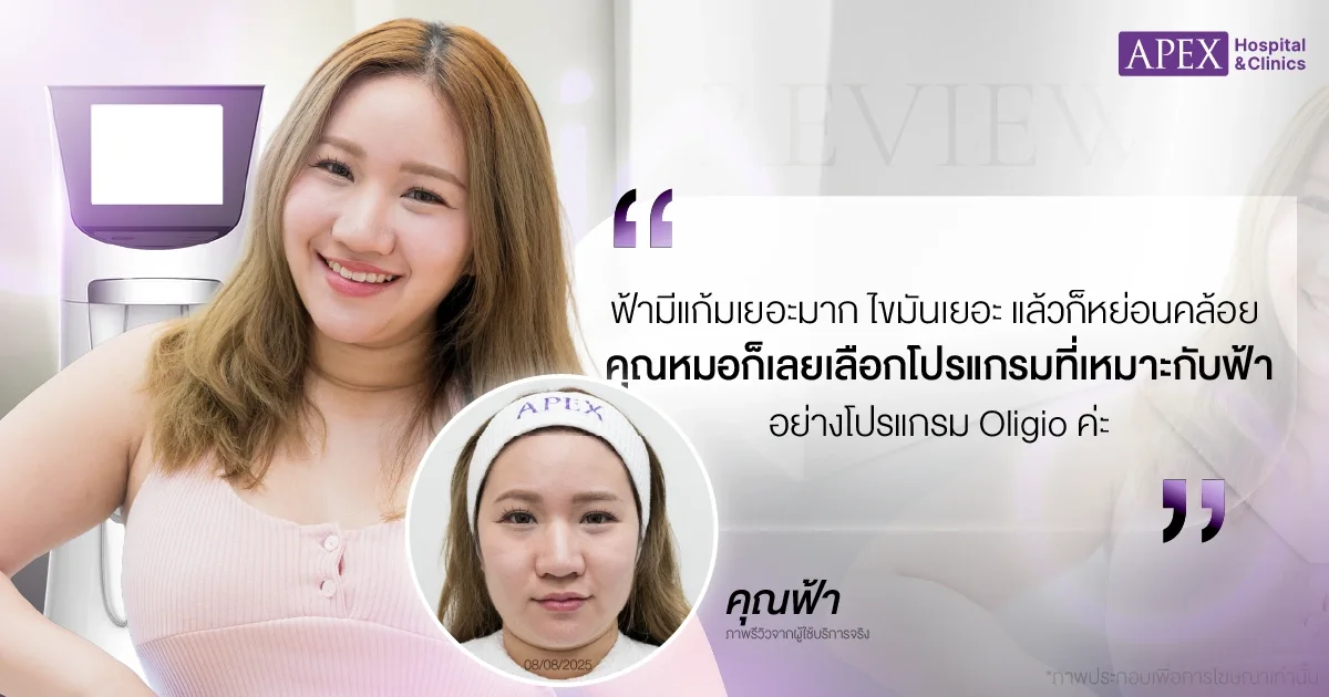 Oligio รีวิว โดยคุณฟ้า