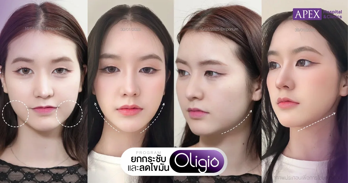 Oligio รีวิว