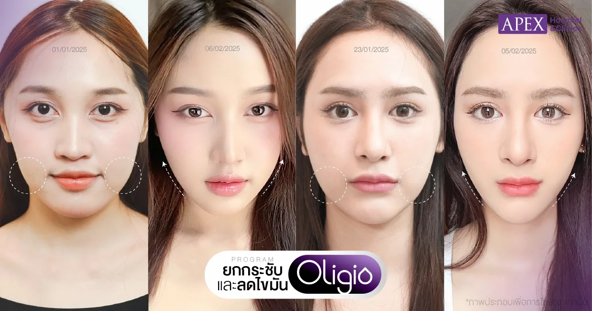 Oligio รีวิว