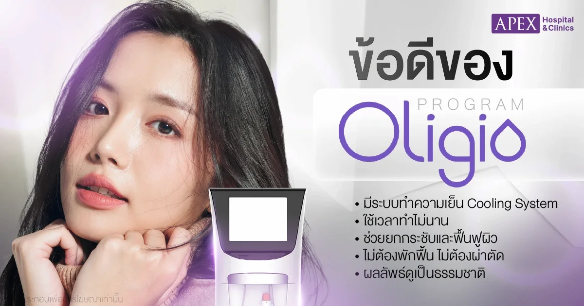 ข้อดีของ Oligio
