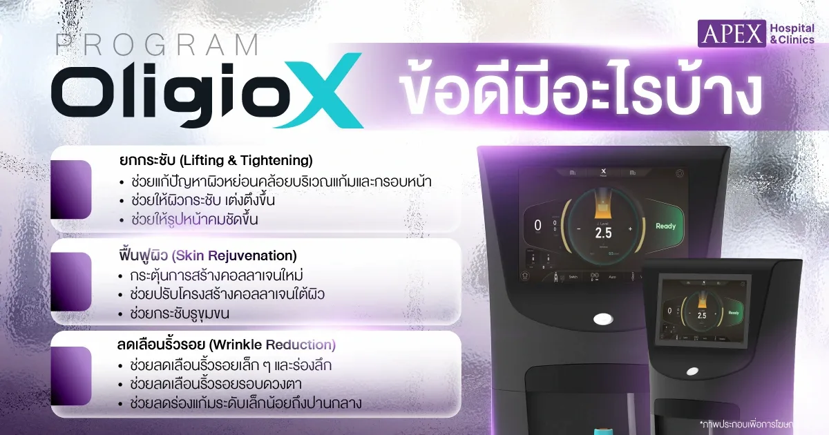 ข้อดีของโปรแกรม OligioX