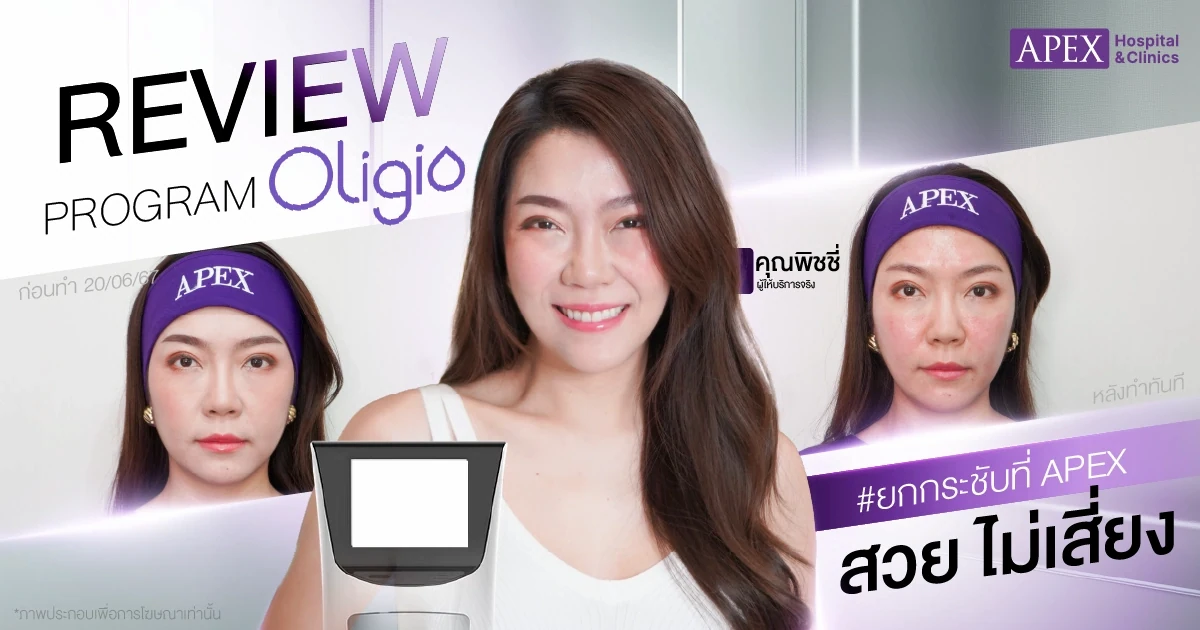 รีวิว Oligio vs Ultraformer 