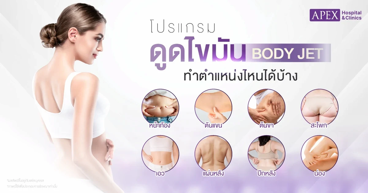 ตำแหน่งดูดไขมัน Body Jet
