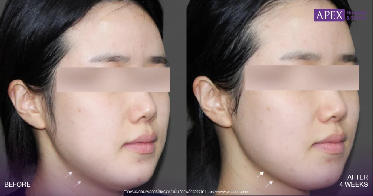 รีวิว OligioX 