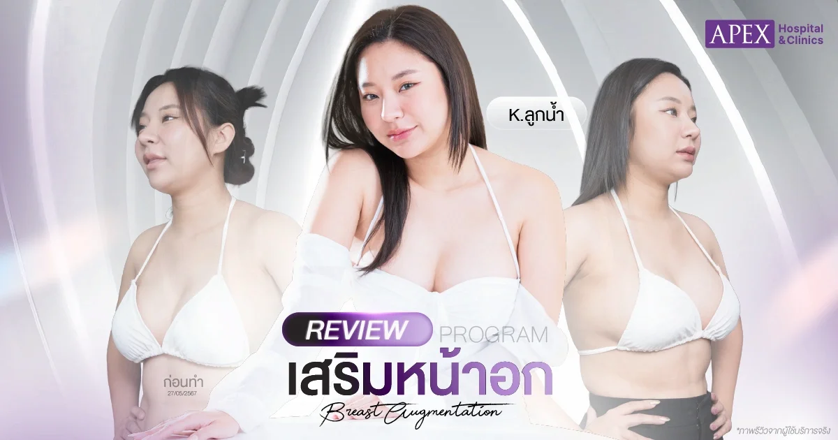 รีวิวเสริมหน้าอก