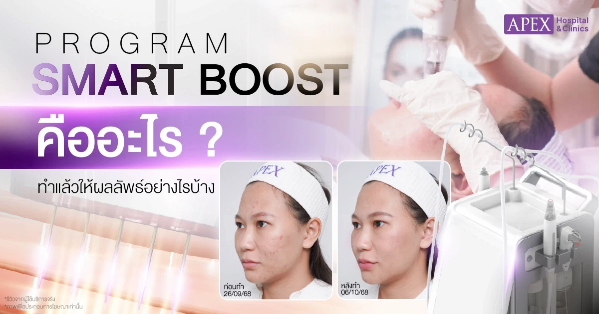Smart Boost