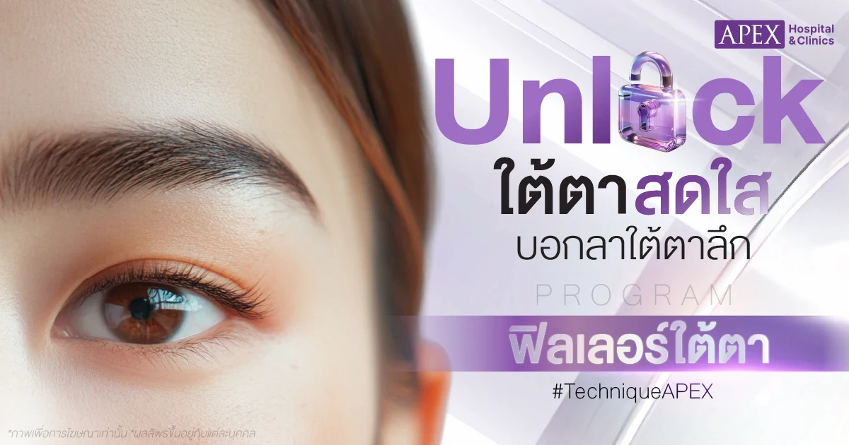 ฟิลเลอร์ใต้ตาลึก