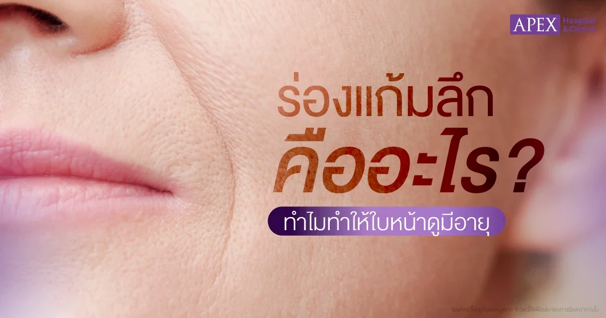 ร่องแก้มลึก คืออะไร