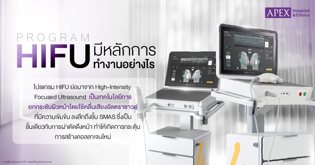 Hifu คืออะไร