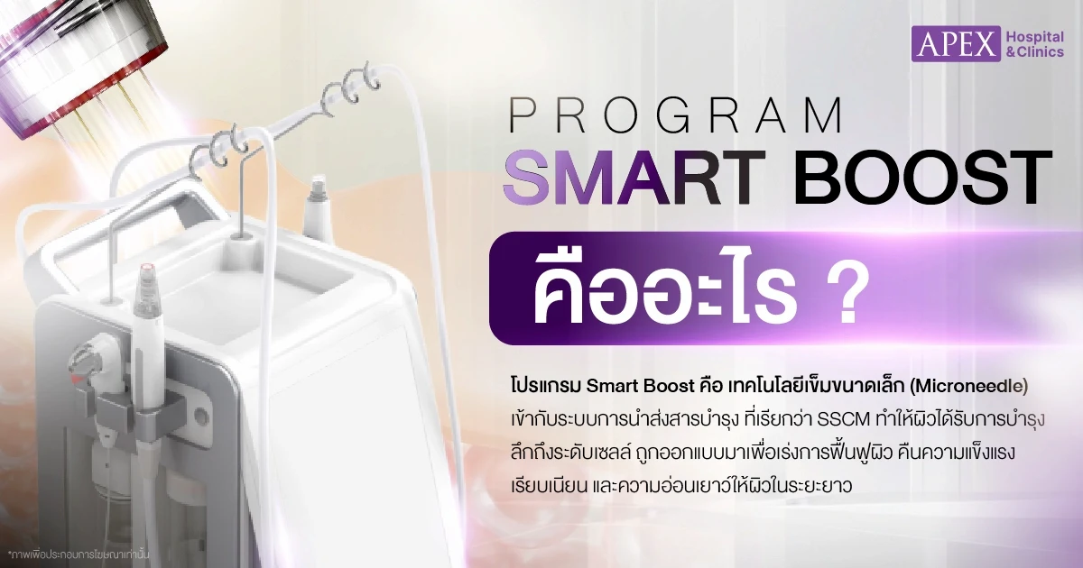 Smart Boost คืออะไร