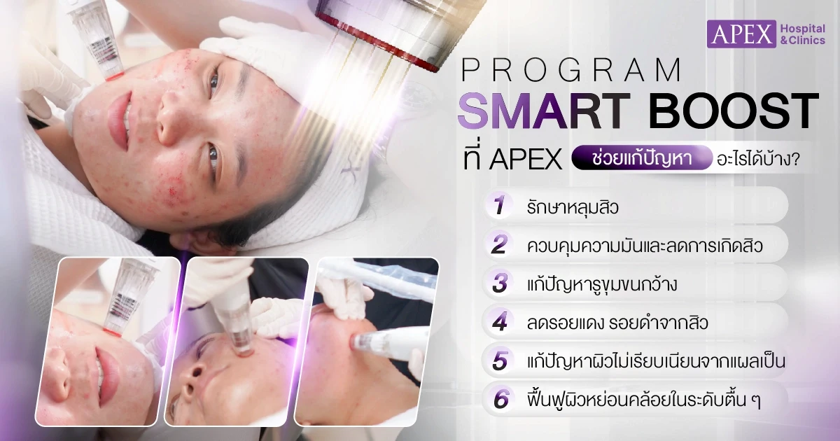 Smart Boost ช่วยแก้ปัญหาอะไร