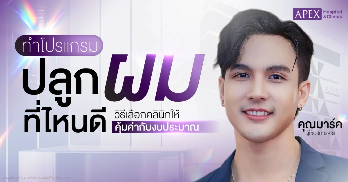 ปลูกผมที่ไหนดี